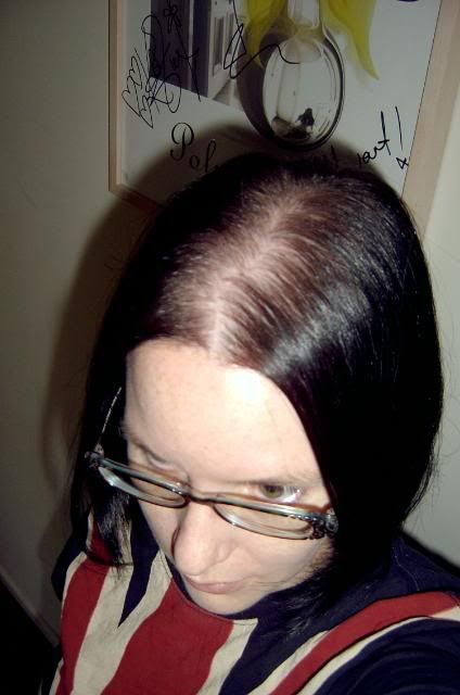 Hair Extensions 101 View Topic Install Tips For Super Oily