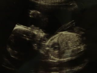 20weekscan006.jpg