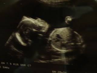 20weekscan007.jpg