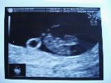 earlyscan001-2.jpg